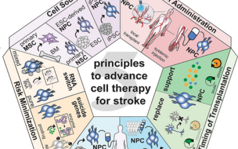 瑞士苏黎世大学最新发文：中风后干细胞治疗需要遵循哪五项原则？