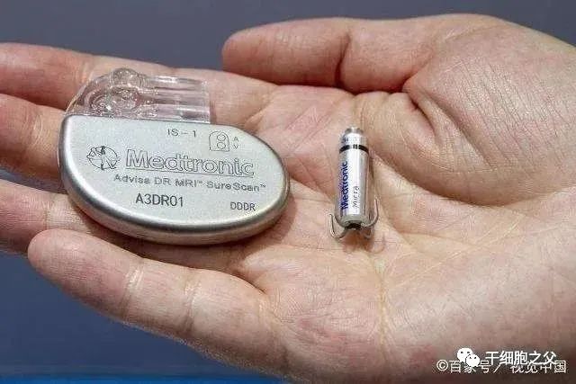 30例干细胞移植治疗帕金森的临床研究案例