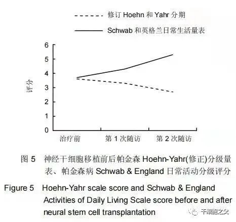 30例干细胞移植治疗帕金森的临床研究案例
