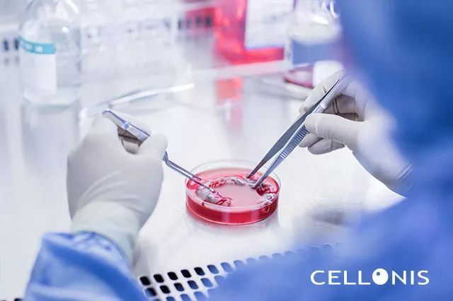 脐带间充质干细胞治疗渐进，已开展25种疾病的临床应用研究！