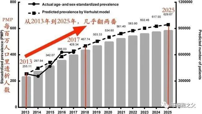 “逆转”肾病指数，干细胞修复肾损伤