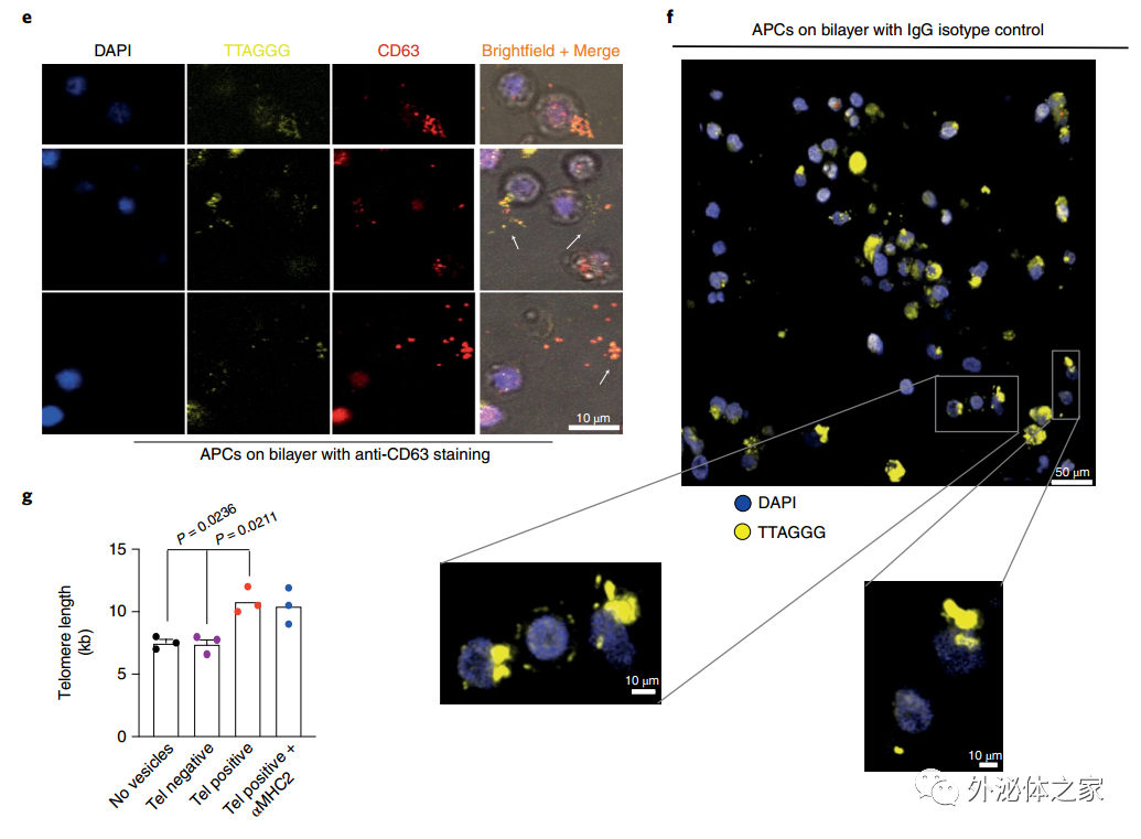 Nat Cell Biol：细胞外囊泡转移端粒，T细胞抵抗衰老新机制