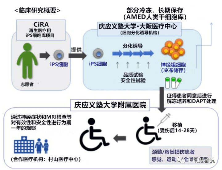 iPSC细胞疗法在日本的临床研究