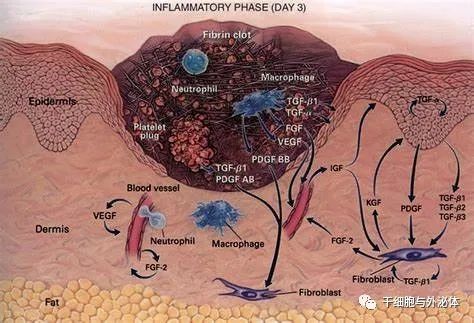 间充质干细胞促进创面愈合
