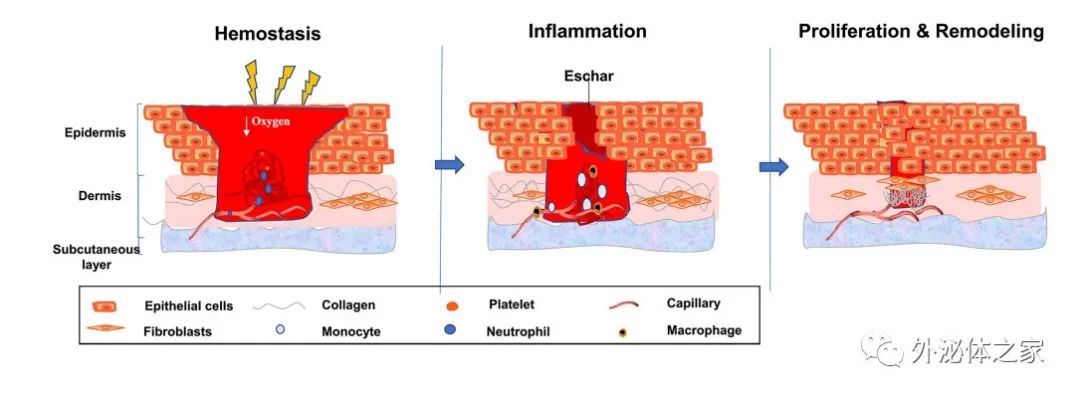 Int J Nanomedicine |苏北人民医院关兵和佛山市第一人民医院王茂华团队：外泌体在全喉切除术后咽瘘中的作用