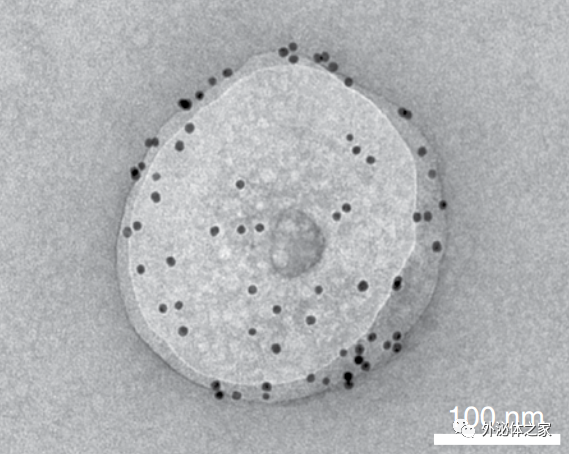 Nat Cell Biol：细胞外囊泡转移端粒，T细胞抵抗衰老新机制