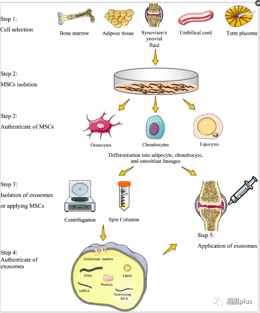 华西医院何成奇教授 |干细胞治疗骨关节炎 如何改进才能提高疗效