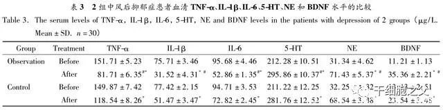 干细胞疗法在精神疾病领域的临床研究案例