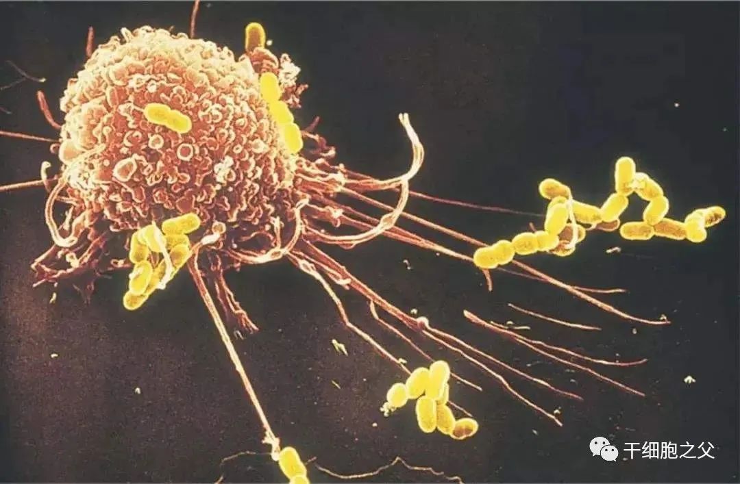 NK细胞：人体免疫的广谱杀手，防癌、抵御病毒、抗衰老