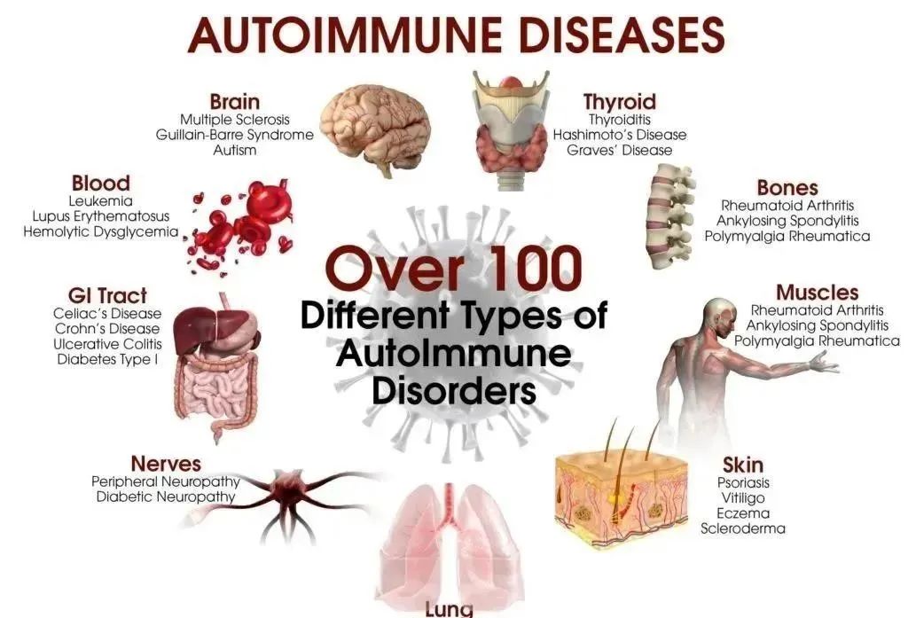 间充质干细胞，80多种自身免疫性疾病患者的新希望