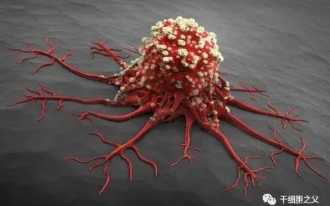 癌症免疫治疗新力量——NK细胞疗法