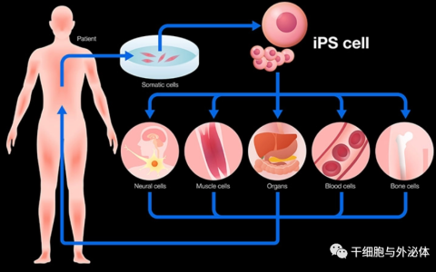 iPS细胞治疗糖尿病取得重大进展 | Science Advances