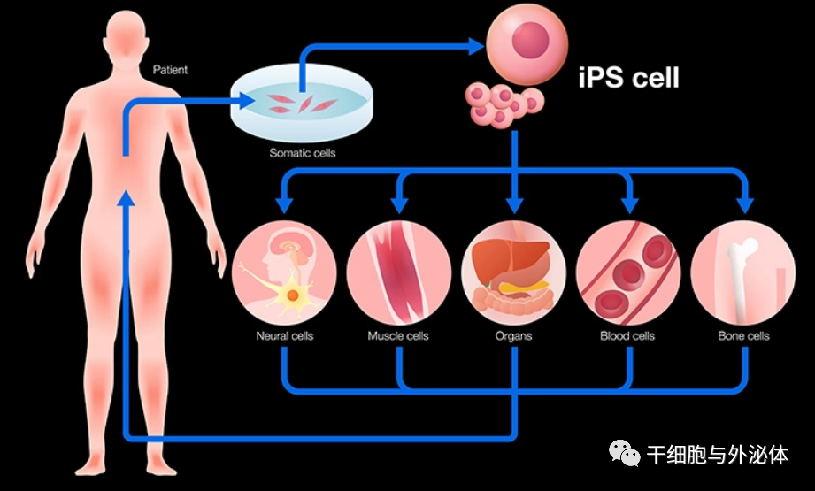 iPS细胞治疗糖尿病取得重大进展 | Science Advances