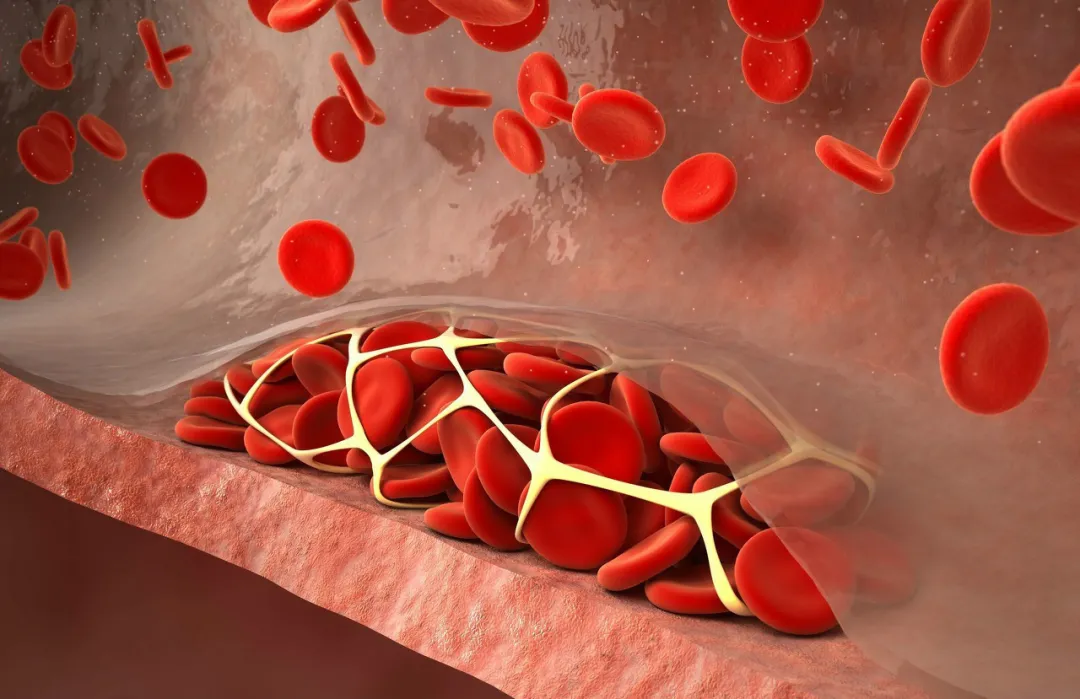 干细胞可改善高血脂指标，有效预防“三高”并发症！