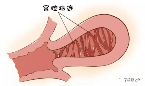 干细胞由内而外，呵护女性健康与美丽