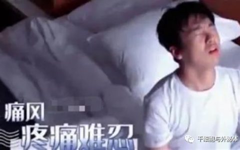 郭麒麟患痛风，干细胞成为治疗痛风新疗法