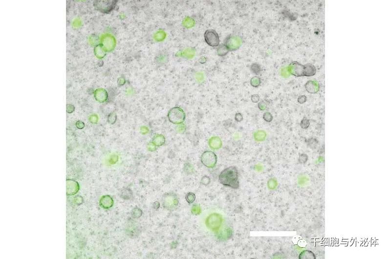 人iPS细胞衍生间充质细胞成功生成肺泡类器官