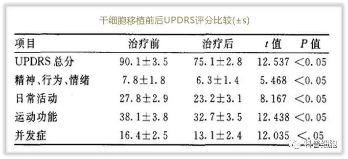 干细胞疗法 | 干预各系统疾病多案例分享