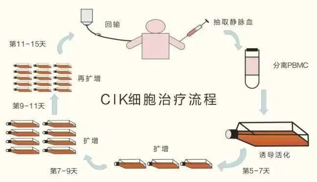 2022中国临床肿瘤学会（CSCO）肝癌诊疗指南：将CIK细胞疗法纳入肝切除术后辅助治疗策略