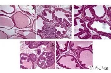 前列腺炎、不孕症、ED——干细胞有效修复男性生理机能！