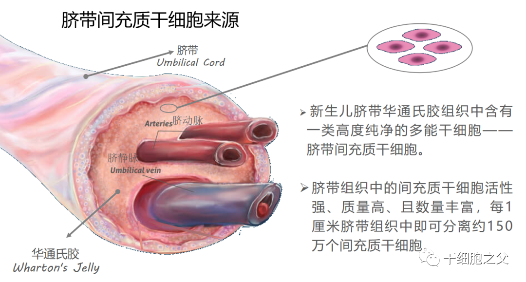 明星干细胞丨脐带间充质干细胞已应用在25种疾病的临床研究中