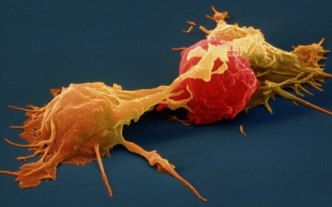 NK细胞疗法：抗肿瘤第一道防线