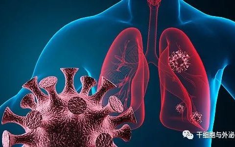 CIK系列一 | CIK细胞对肺癌患者的临床疗效