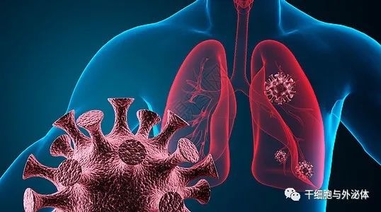 CIK系列一 | CIK细胞对肺癌患者的临床疗效