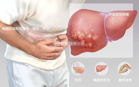 2022中国临床肿瘤学会（CSCO）肝癌诊疗指南：将CIK细胞疗法纳入肝切除术后辅助治疗策略