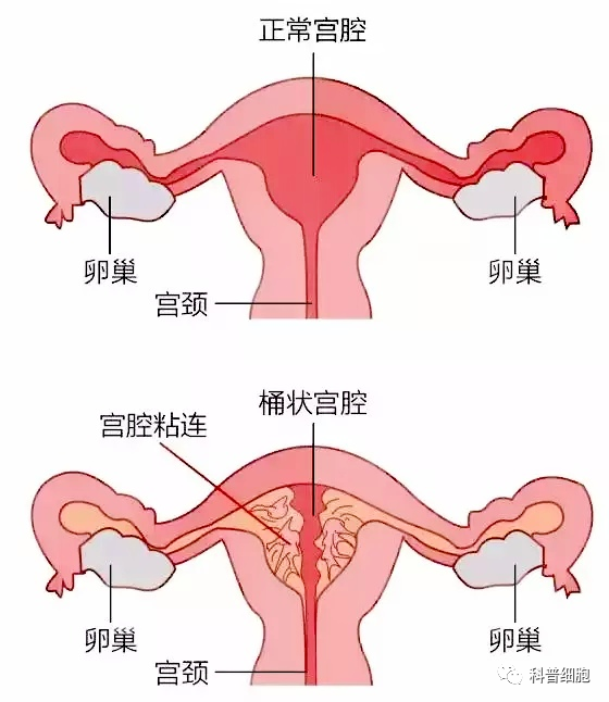 干细胞疗法 | 干预各系统疾病多案例分享