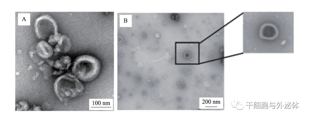 热点前沿 | 外泌体成为中药新的活性成分