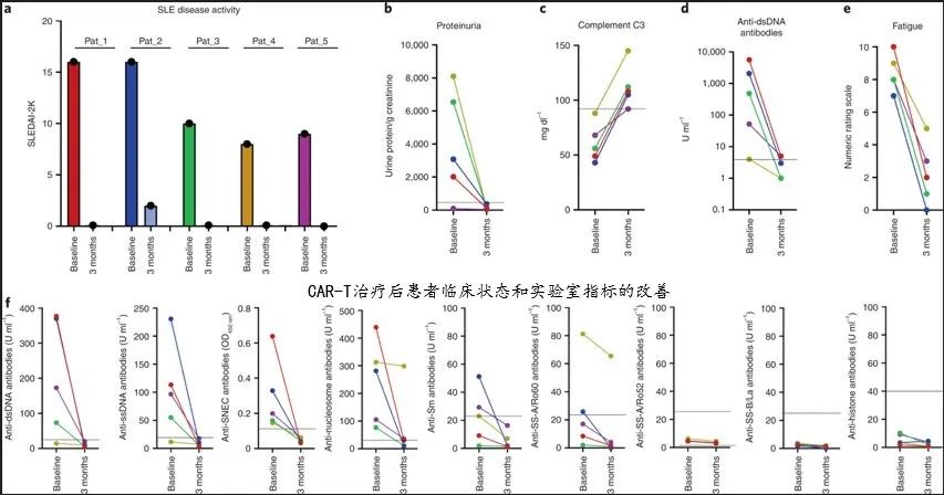 难治性系统性红斑狼疮的CAR-T治疗