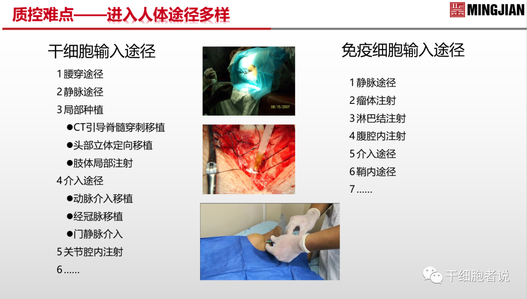 南海论道：从临床视角探讨细胞产品的质控要点