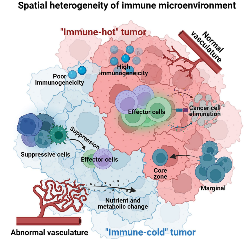如何理解肿瘤免疫微环境的异质性？