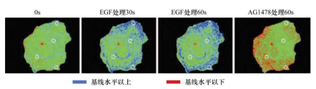 肿瘤生物学：（4）生长因子、受体与癌症