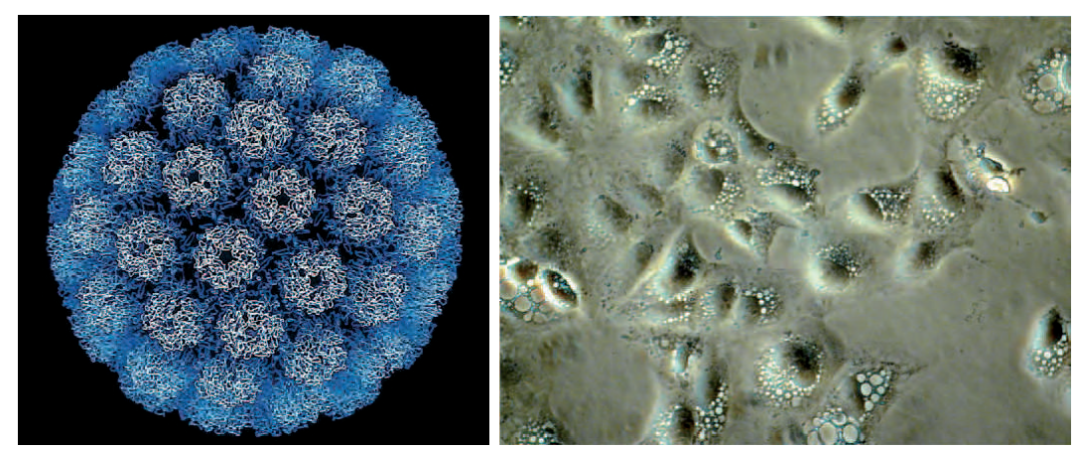 肿瘤生物学：（2）肿瘤病毒