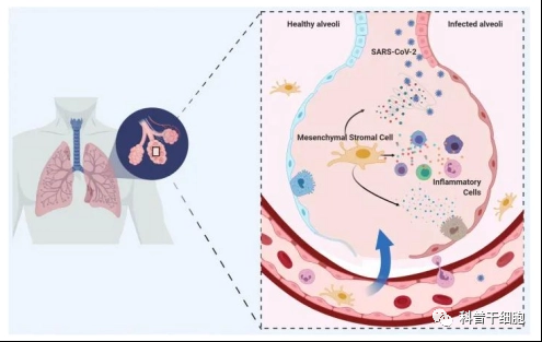 干细胞外泌体雾化能修复“小阳人”肺部损伤，极大减轻症状