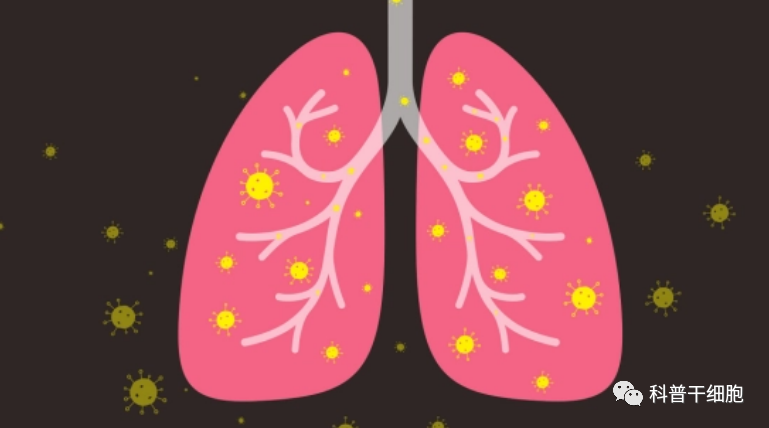 干细胞外泌体雾化能修复“小阳人”肺部损伤，极大减轻症状