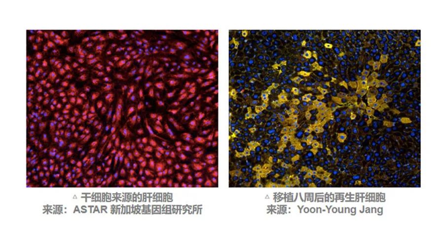 干细胞疗法多途径促进器官修复，攻克肝功能失代偿难题
