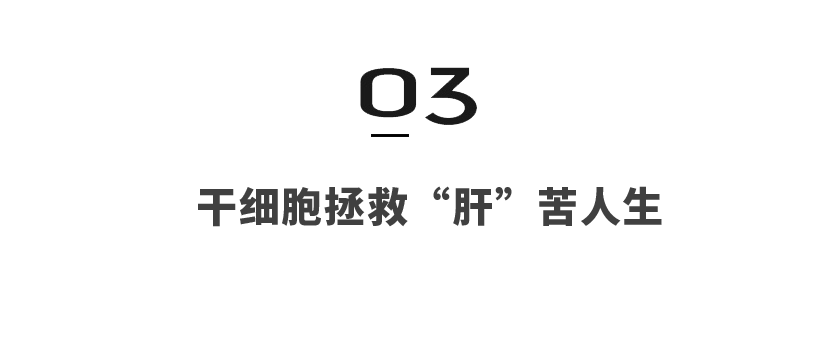 干细胞促进器官修复，攻克肝功能失代偿难题