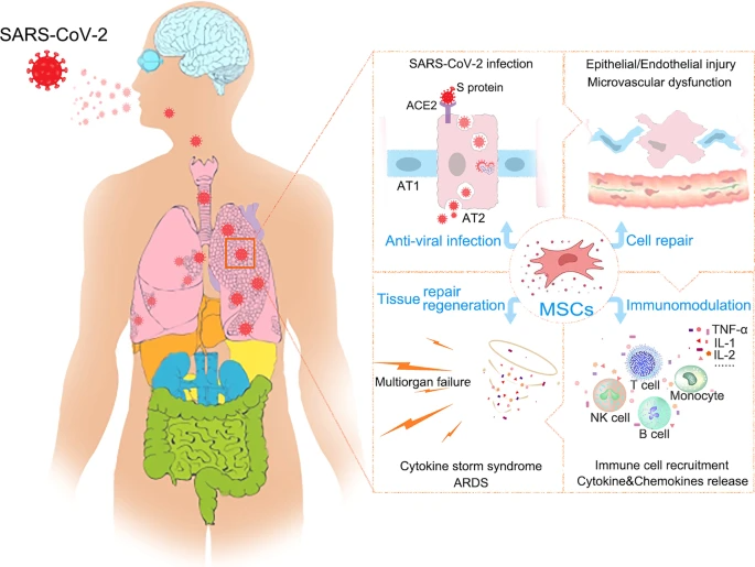 干细胞治疗长新冠的7大效果，改善免疫功能、缓解肺损伤等