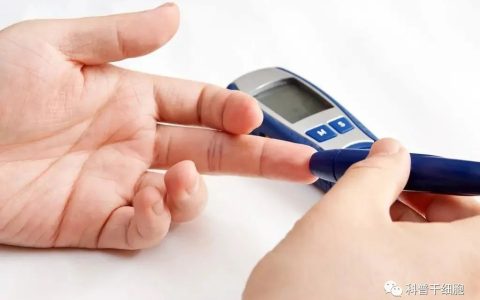 干细胞对II型糖尿病总有效率68%，3人摆脱胰岛素注射