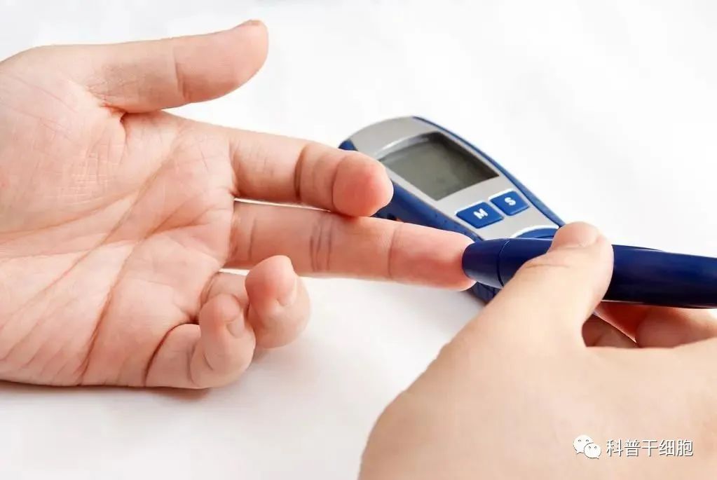 干细胞对II型糖尿病总有效率68%，3人摆脱胰岛素注射