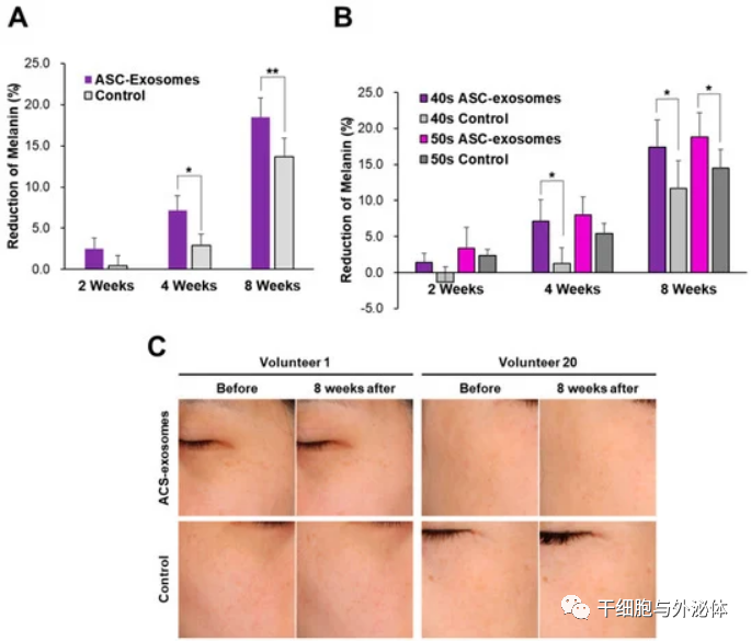 21名女性双盲试验：证明外泌体的皮肤增白功效 | Cosmetics