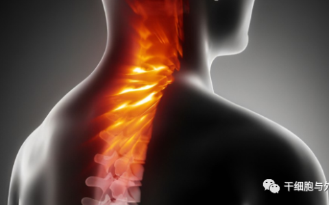临床证明外泌体治疗脊髓损伤，运动、反射和感觉明显改善