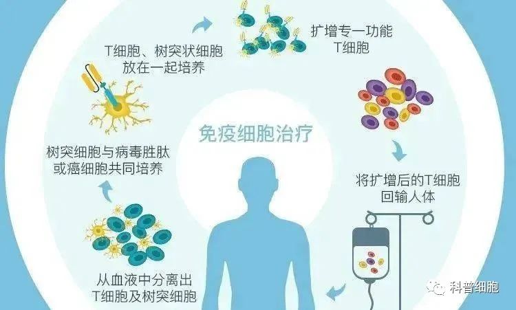 选择干细胞治疗还是免疫细胞治疗，你了解吗？