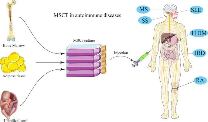 新综述：间充质干细胞治疗在自身免疫性疾病中的临床应用