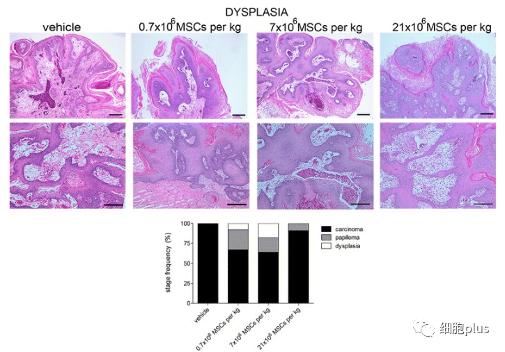 重大争议有答案！全身用同种异体间充质干细胞不会加重癌前病变发展！