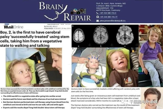 斥资3.7亿元，开发干细胞治疗脑损伤和脑瘫