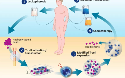 实体瘤新进展：NK细胞用了21天消灭它！